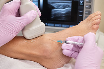 ultrasound-guided-injections
